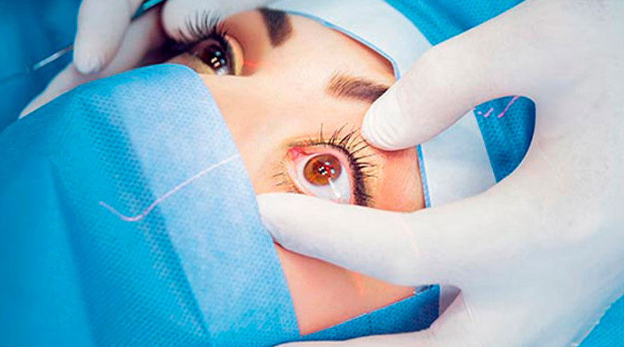 Cirurgia refrativa